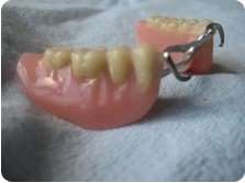 Tandteknikeren - delproteser