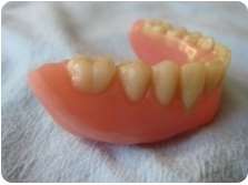 Tandprotese undermund